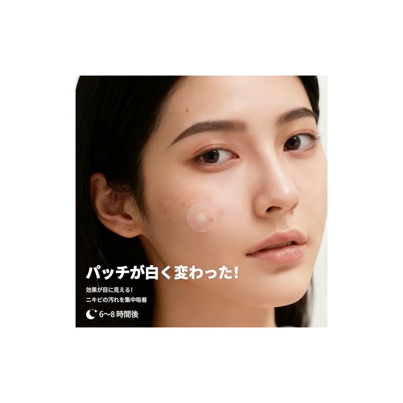 FERNIDA スポットパッチ ハイドロコロイド 肌荒れケア 肌色 140pcs pimple patch スキンケア部分パック 可愛い