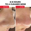 HydroClear Nose Patches – Anti-Acne & Blemish Remover for T-Zone