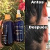 Pack 3 Set Anticaida Shampoo + Suero Crecimiento + Gel