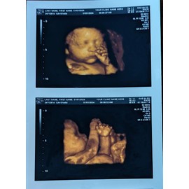 Prank 3D COLOR Customized Fake Ultrasound Strip of 2 Photos