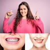 Rubber Bands for Braces, 1040 Pcs Black Orthodontic Ligature Ties