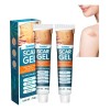 Crema Para Eliminar Cicatrices, Gel Avanzado Para Cicatrices