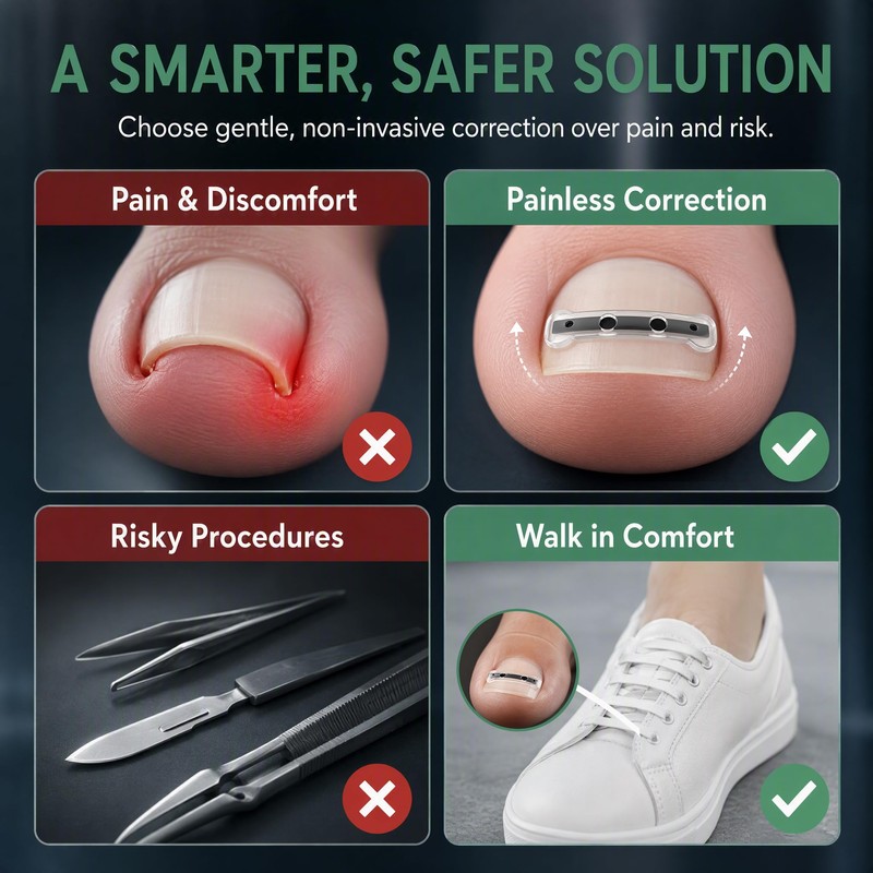 Titanium Alloy Ingrown Toenail Treatment, Nail Tools