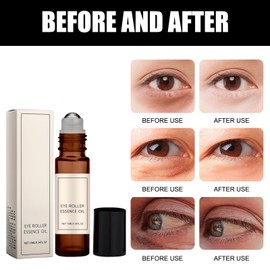 Castor Oil and Frankincense Roller Ball, Castor Oil Eye Roller Time Eraser Eye Care Products for Under Eye Area Lifts Firming(1pc, 10ml)
