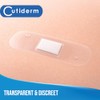 Cutiderm Transparent Assorted Size Plasters 7.2cm x 2.5cm & 5cm