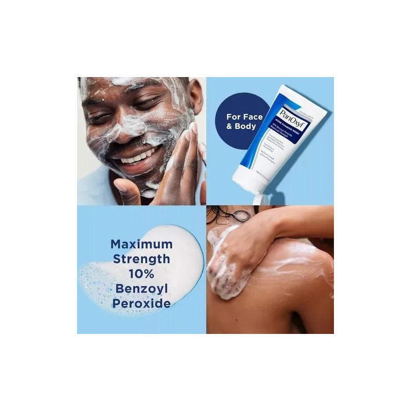 Espuma Lavado Para Acné Panoxyl Peróxido De Benzoilo 10% 3oz