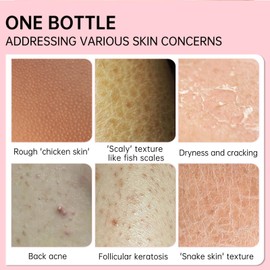 Strawberry Legs Treatment For Women,Bump Eraser Body Scrub, Keratosis Pilaris Treatment,Rough Bumpy Body Cream, Bump Eraser Body Scrub,Smoothing & Buffing Body Scrub Body Care