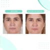 Serious Skincare Limpiador Glicólico De 12 Onzas Lavado Faci