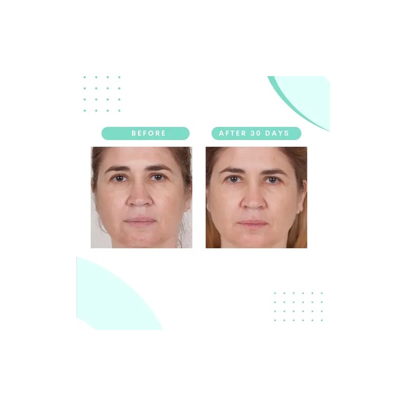 Serious Skincare Limpiador Glicólico De 12 Onzas Lavado Faci