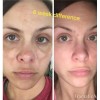 Sérum Antimanchas Facial Admire my Skin Ácido Kójico y Vitamina