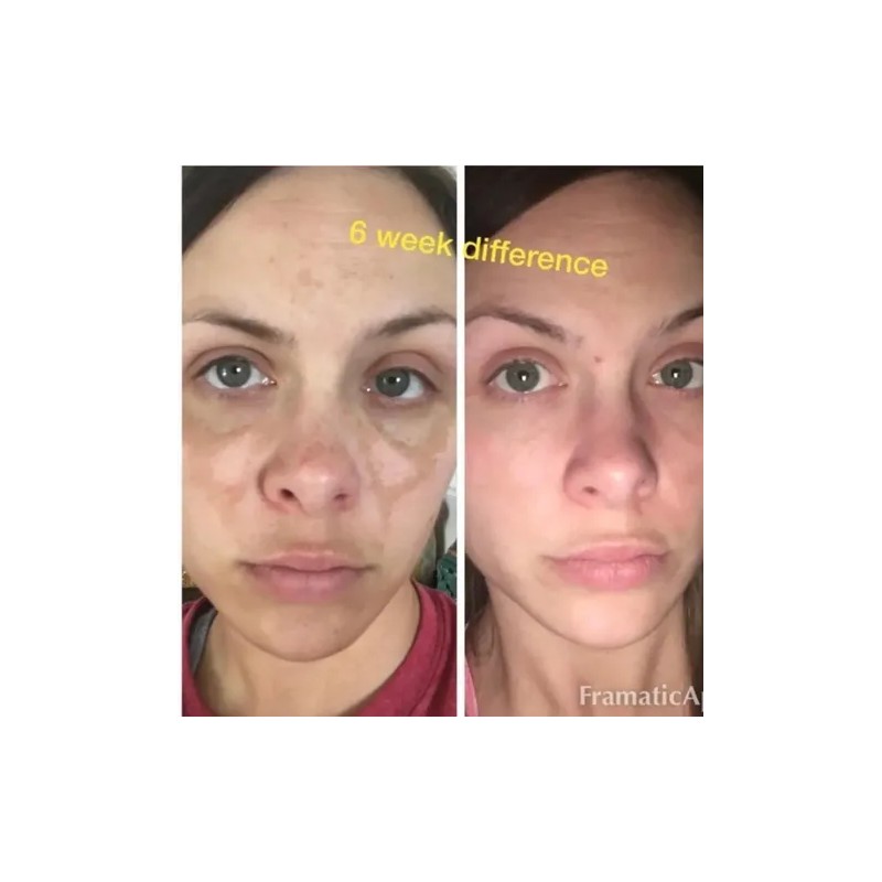Sérum Antimanchas Facial Admire my Skin Ácido Kójico y Vitamina