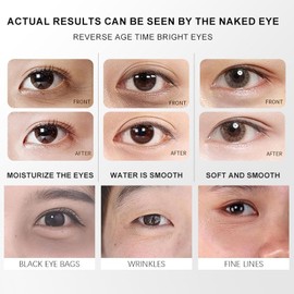 Electric Massage Eye Cream, Polypeptide Dark Circle Treatment, Firming and Anti-Wrinkle, with Gentle Vibration, 1.76 oz