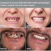 Denture Temporary Teeth Filling Kit Top and Bottom Fake Teeth,