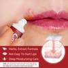 KOAHDE Lip Herpes Repair Cream, Herpes Cream for Lip Sores,