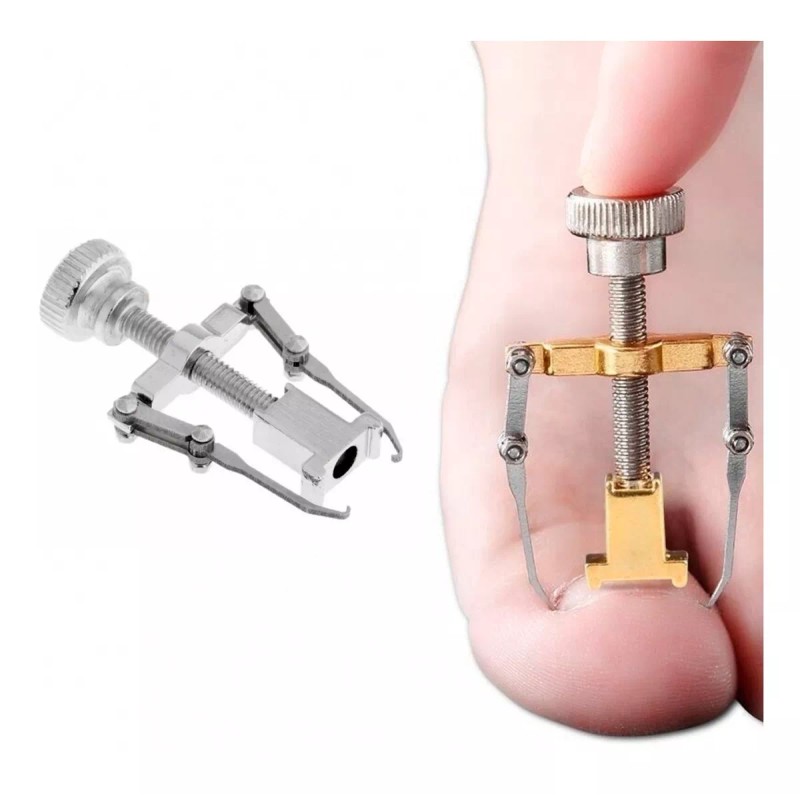 Corrector uñas encarnadas Kit Corrección Uñas Enterradas Corrector Uñas Encarnadas