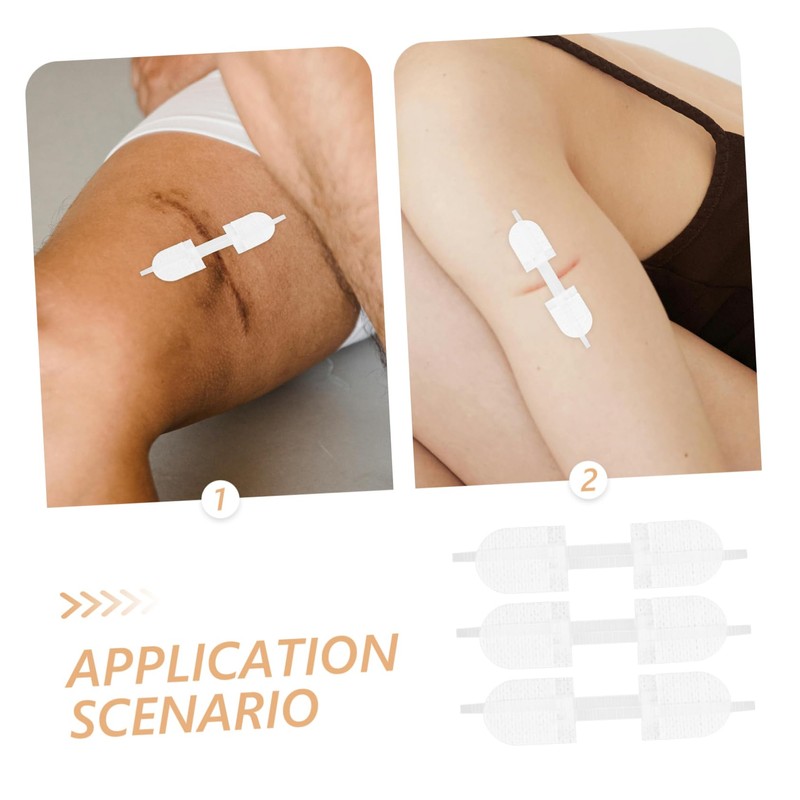 OATIPHO 9pcs Versatile Closure Strips Emergency Wound Closure Device Scar