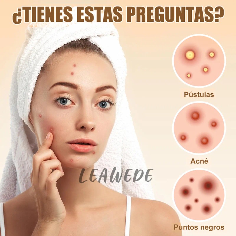 300pzs Parches Estrella Star Anti Acne Espinillas Granos