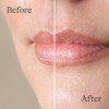 Lansinoh Lanolin Lip Balm, 2 Pack, 0.25 oz Each, Ultra-Moisturizing