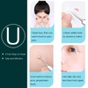 5PCS Blackhead remover, Pimple Removal Tools, Blemish Whitehead Popping Removal,