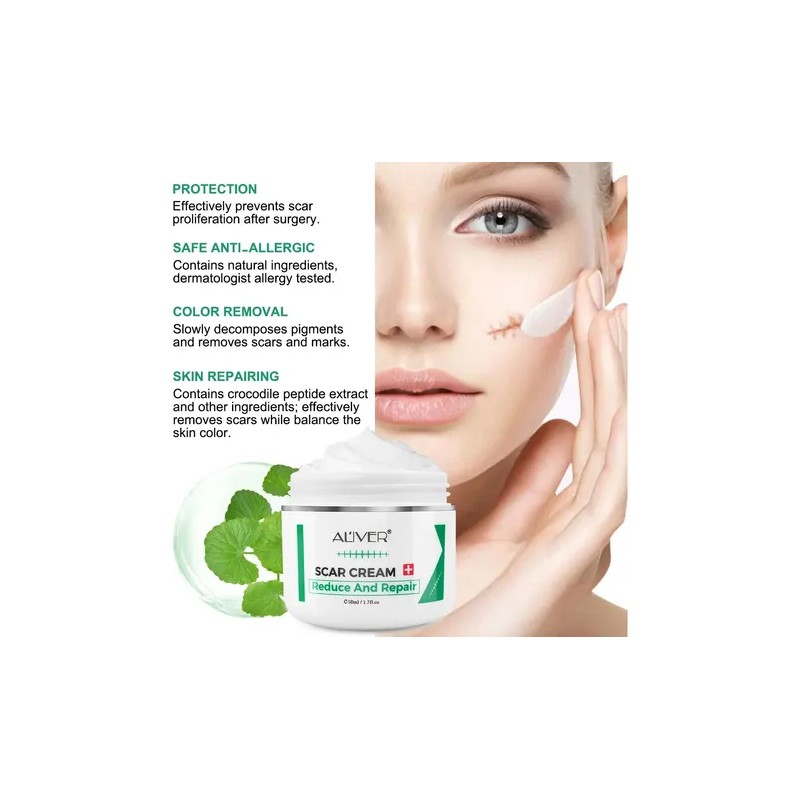 Crema Apoyo Desvanecimiento Cicatrices Cacarizos Queloides