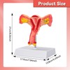 SimCoach Human Uterus and Ovary Anatomical Model, Female Reproductive Model