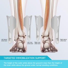 Hocafer Ankle Brace for Women & Men - Ankle Support Sprained Ankle Brace for Achilles,Tendon,Sprain,Injury Recovery,Ankle Support Brace for Running, Basketball, Football (Grey,S,Left)