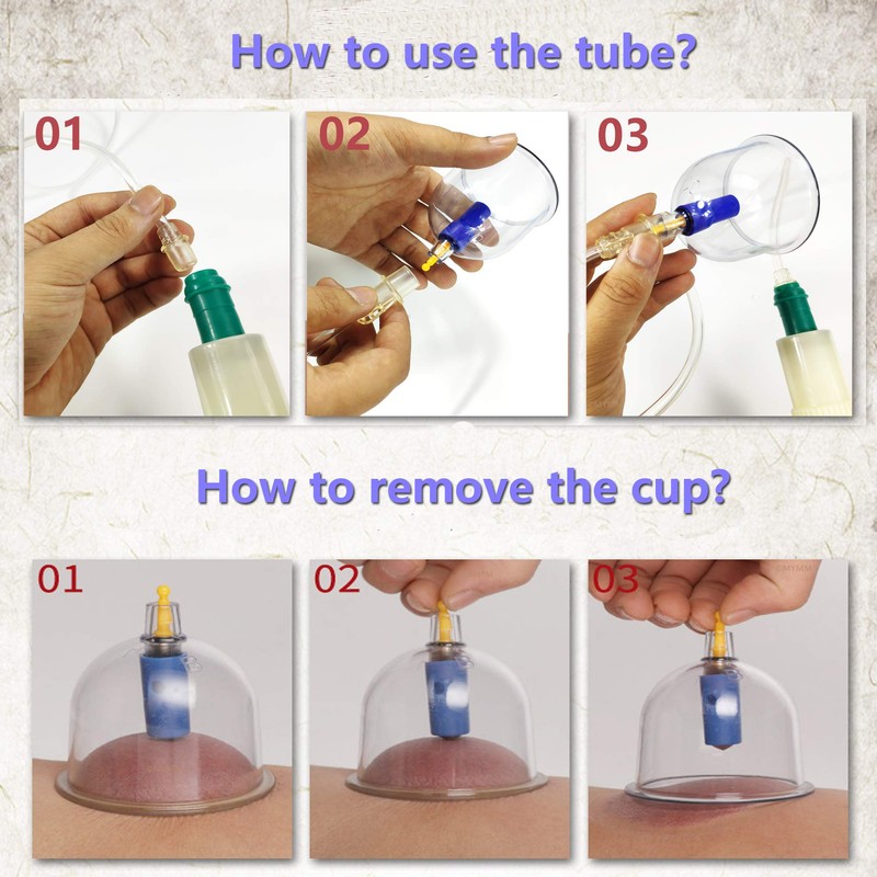 12 Cupping Cups Sets Biomagnetic Traditional Professional Chinese Therapy Massage