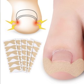 Ingrown toenail correction protective tape band 30pcs Ingrown toenail correction band 30P 50ea