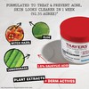 Thayers Blemish Clearing Acne Pads, Salicylic Acid Acne Treatment for