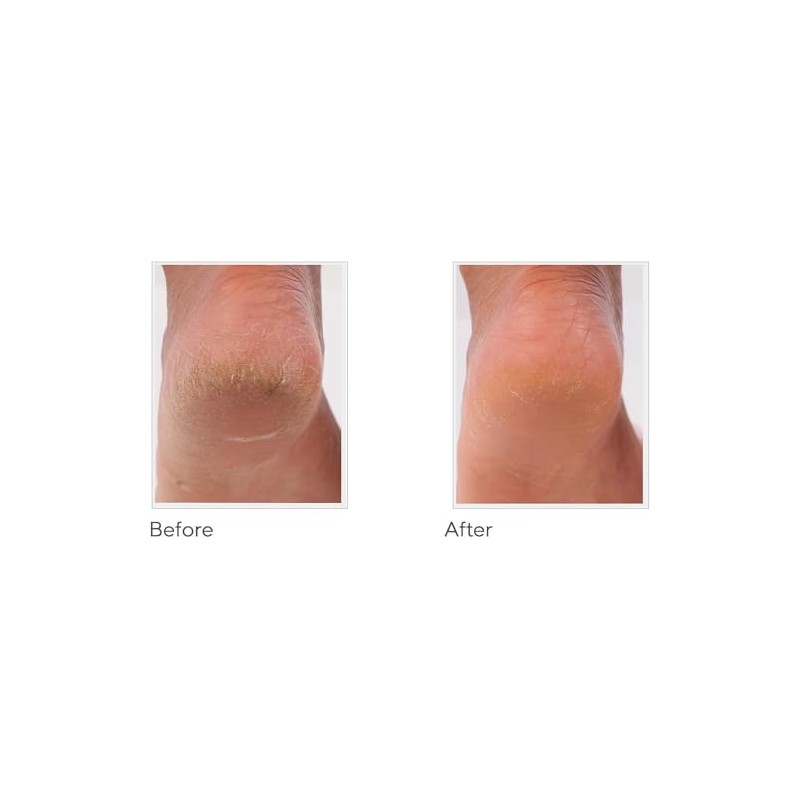 Spa-Rific Juego de 3 Limas Nano: Limas de Uñas de