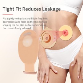 DERAYMI 30 Pack Moldable Ostomy Barrier Rings, 4mm Thickness Sting-Free Elastic Ostomy Rings Hydrocolloid Ileostomy Barrier Rings Secure Seal for Colostomy Bags