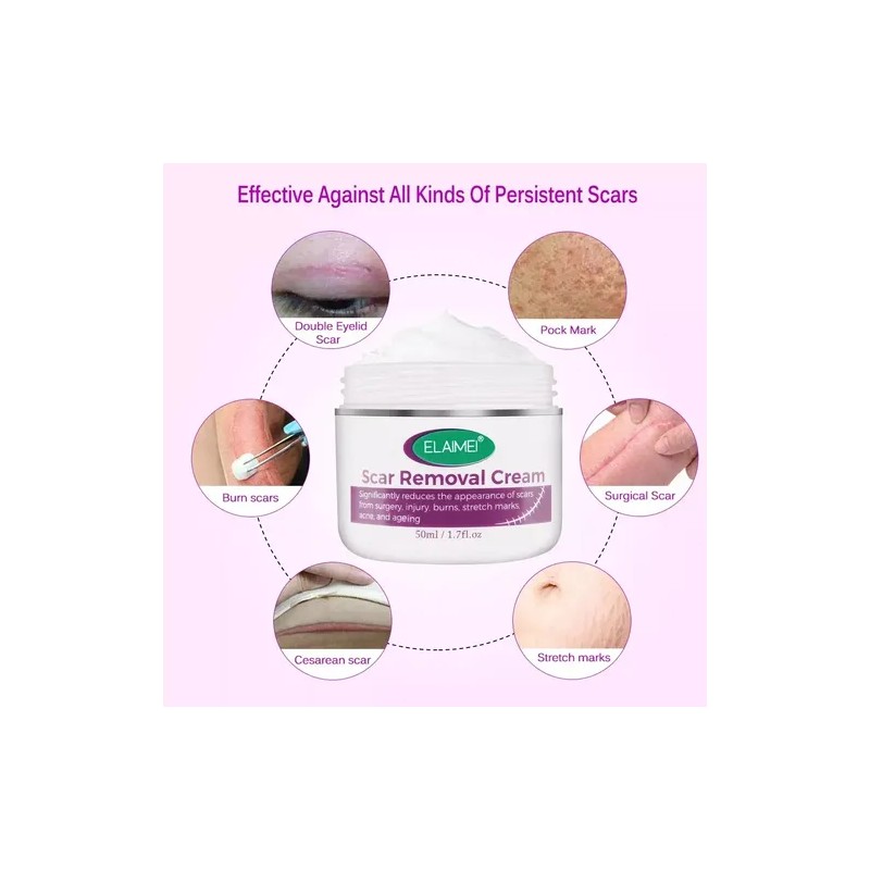 Kit Cicatrices Cirugías Cesárea Crema Y Parche Silicón