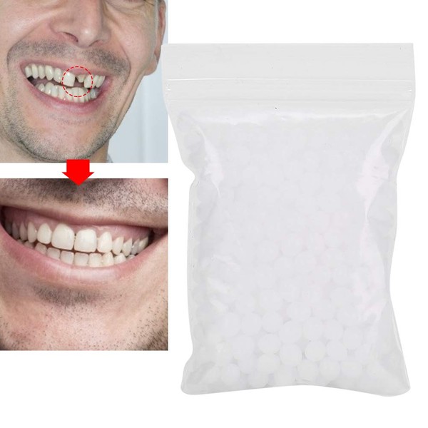 Teeth Repair Beads for Missing Tooth Filling Material With Broken Teeth, Multifunction Teeth Repair Set Plastic(20g)