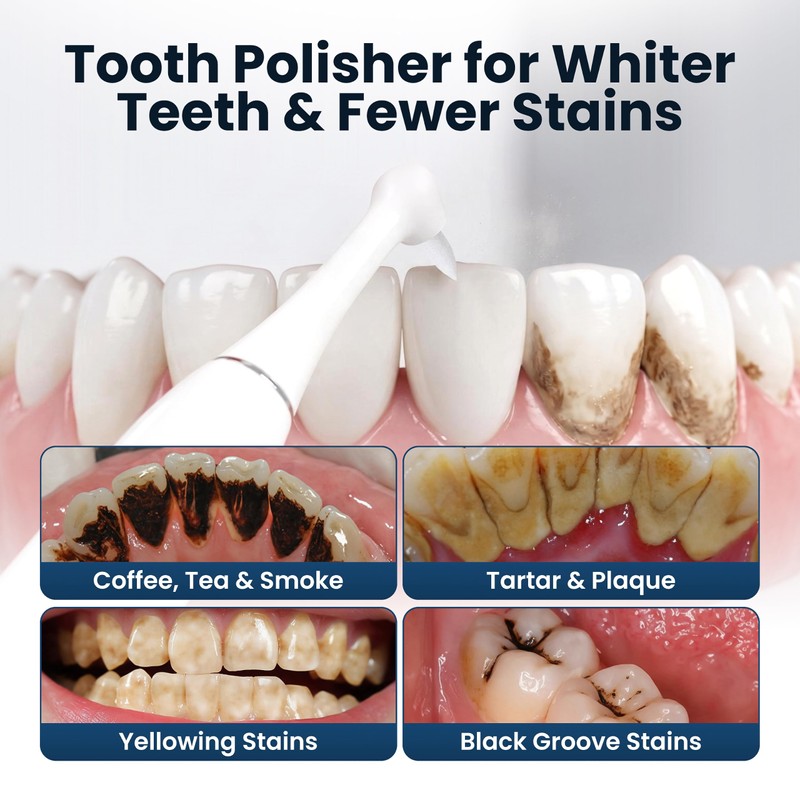Tooth Polisher for Teeth，Teeth Polishing Kit for Daily Cleaning