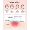 360 Pieces Invisible Pimple Patches, Hydrocolloid Spot Patches, Acne Treatment
