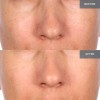 SKINN Cosmetics Mantle Milk Skin Repair – 100 Hours of