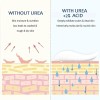 Crema Para Pies Con 45 % De Urea Y 2