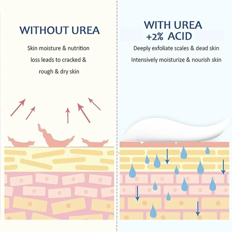 Crema Para Pies Con 45 % De Urea Y 2