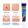 Urticaria Antipruritic Cream 20g Natural Herbal Anti Itch Ointment
