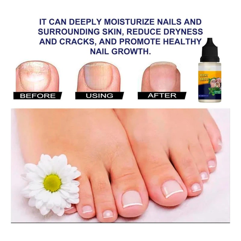 Gotas De Plantas Para El Cuidado De Las Uñas, Aceite