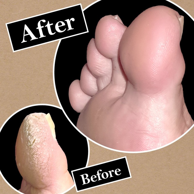 Perorin Foot Peeling Pack, Set of 2 Matcha, 1 x