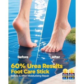 Crema de urea 60 por ciento con 2% de ácido salicílico, crema de pies de máxima resistencia para pies ásperos y secos agrietados, manos y codos, remov