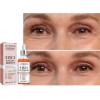 Sérum Facial Jaysuing Antiacné Niacinamida 5% 30ml Rostro