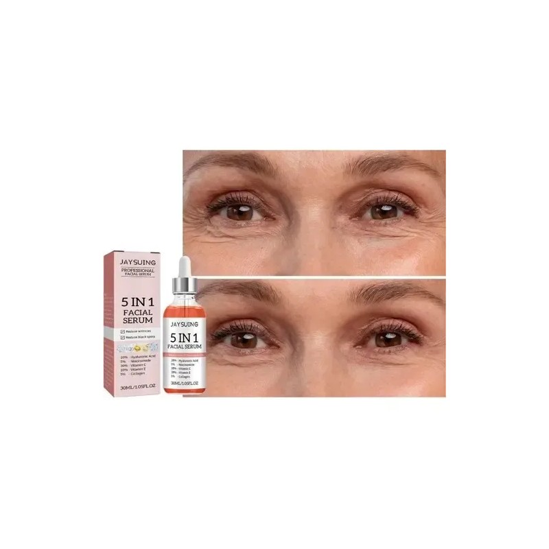 Sérum Facial Jaysuing Antiacné Niacinamida 5% 30ml Rostro