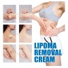 Jx Crema Limpiadora Para Lipomas Nc4c, Bloqueadora Grasa, 1