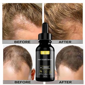 Men and Women H/air Growth Serum,H/air Growth Oil,Hair Growth Serum for Faster Hair Growth,Hair Oil for Dry Damaged Hair,Reduces Hair Loss,Promotes Hair Regrowth,for Stronger Thicker Longer Hair