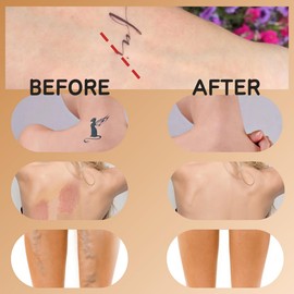 Professional Concealer,Tattoo Cover Up Makeup,Full Coverage Tattoo Concealer Cream,2 Color Buildable 3 Shades Scar Covering Makeup,Sweatproof Waterproof Natural BodyConcealer LegMakeup To Cover Vein