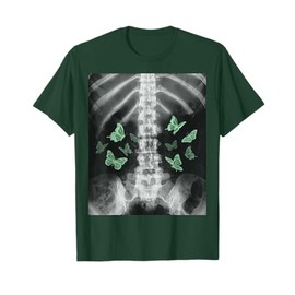 Xray Skeleton Green Butterfly Egirl y2k Harajuku Grunge Edgy T-Shirt