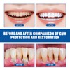 3 PCS Teeth Repair Gel, Gum Protect Repair Gel, Gentle