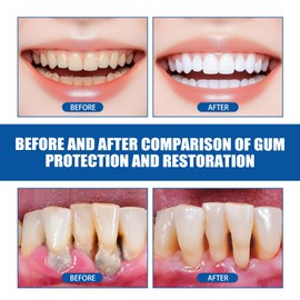 3 PCS Teeth Repair Gel, Gum Protect Repair Gel, Gentle Ingredients，Can Deeply Clean Gums, Effectively Prevent and Improve Gum Problems